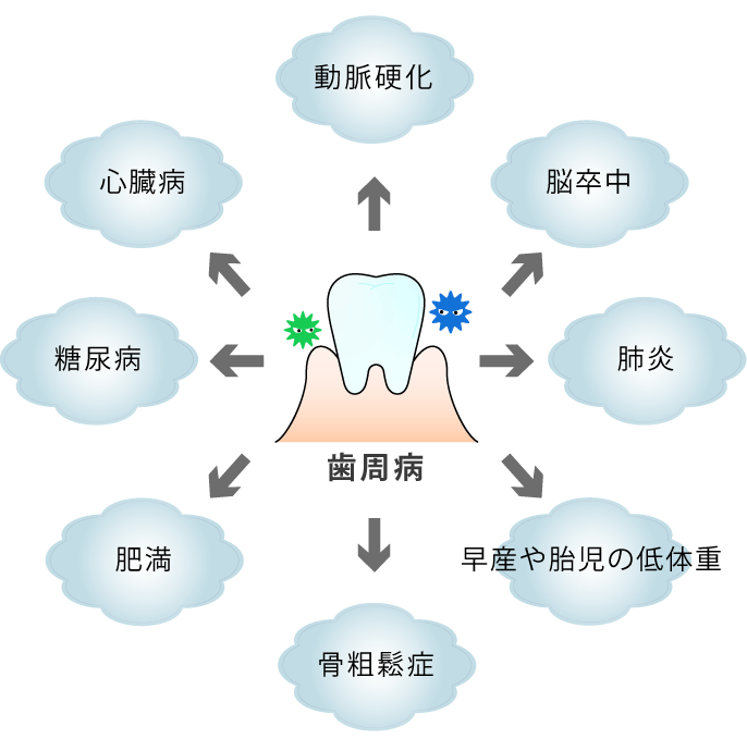 歯周病は全身に影響を及ぼします